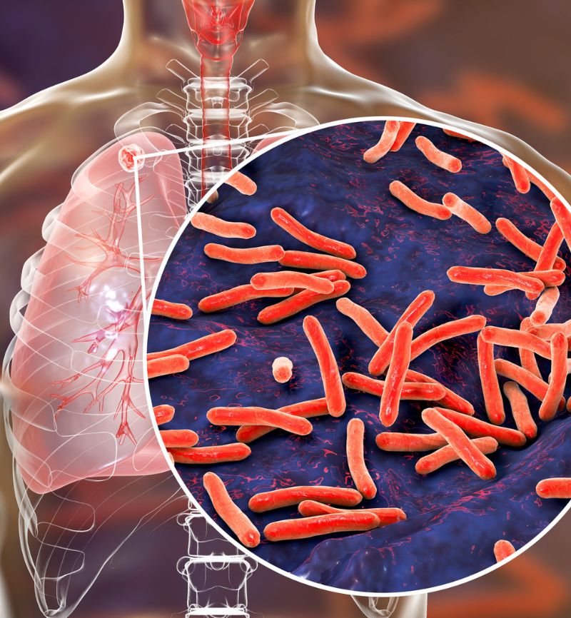 Case Study: Efficient Import, Storage, and Distribution of Diagnostic TB Kits for Research Study in Sub-Saharan Africa